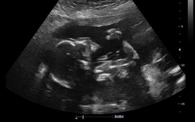 Gender Reveal Videos