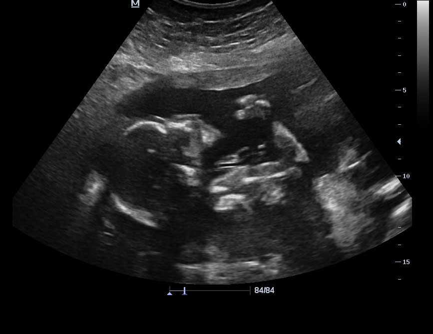 Gender Reveal Videos
